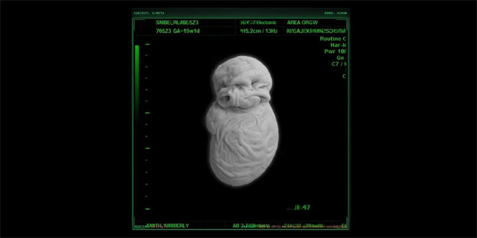 [EUDigitalDeal] WHERE DOGS RUN: ‘Kerosene Chronicles. Greta-Fungus’